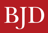 Age and biologic survival in patients with ​moderate-to-severe psoriasis: a cohort study from the British Association of Dermatologists Biologics and Immunomodulators Register (BADBIR)